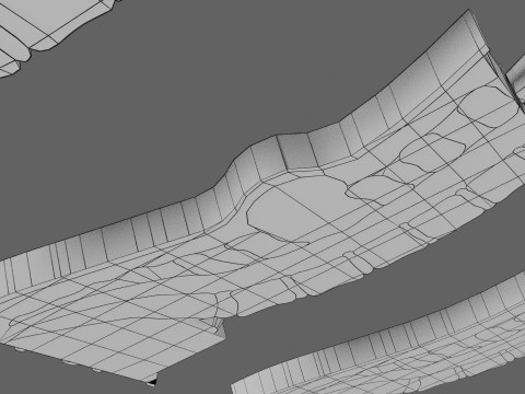 Spina bifida Neural Tube Defect 3D Model