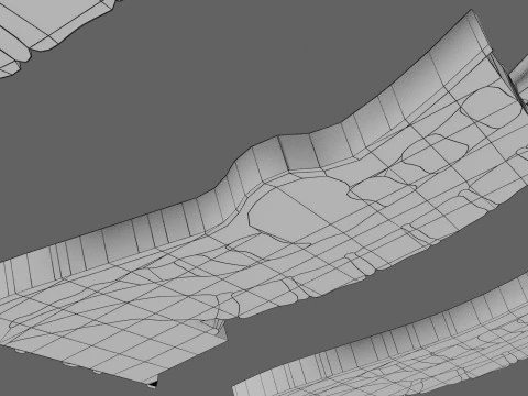 Spina bifida Neural Tube Defect 3D Model
