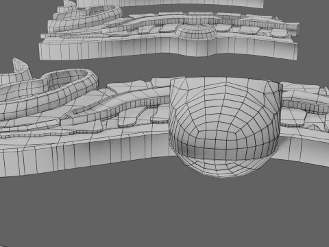 Spina bifida Neural Tube Defect 3D Model