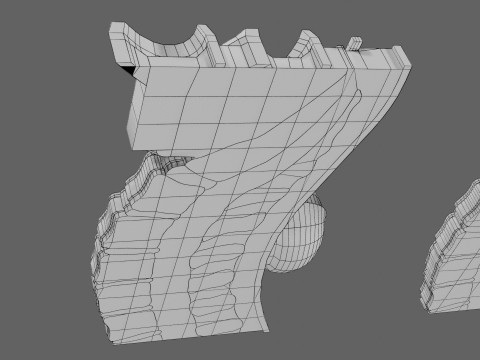 Spina bifida Neural Tube Defect 3D Model