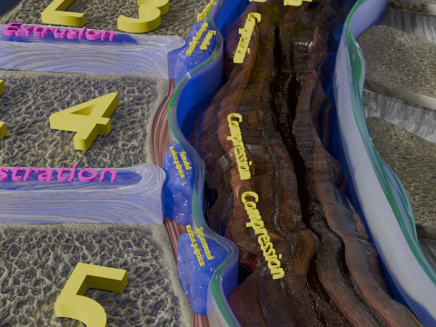Intervertebral herniation slipped ruptured disc 3D 모델