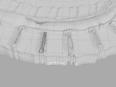 Intervertebral herniation slipped ruptured disc 3D 모델
