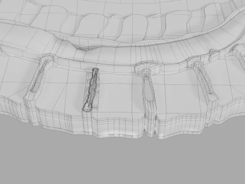 Intervertebral herniation slipped ruptured disc 3D Model