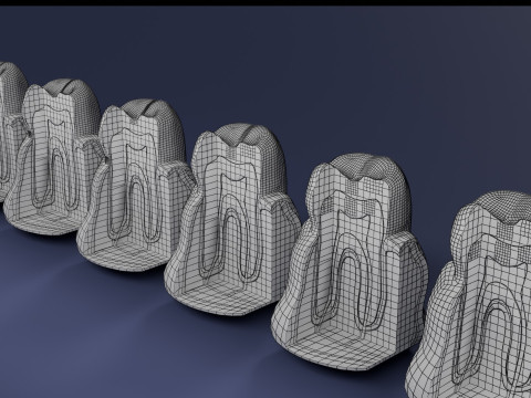 Caries Teeth severity schematic cut sectional 3Dモデル