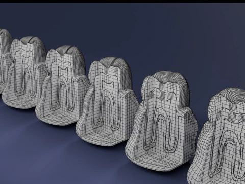 Caries Teeth severity schematic cut sectional 3D Model