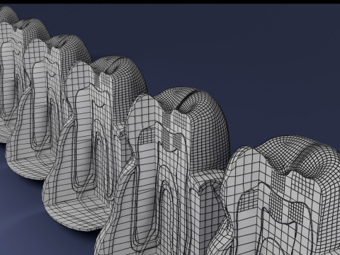 Caries Teeth severity schematic cut sectional 3Dモデル