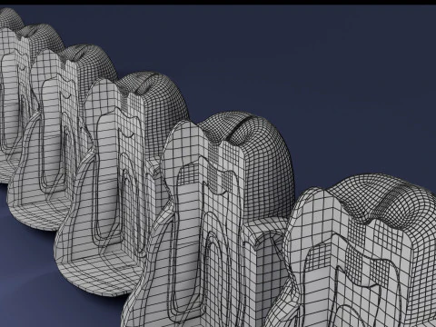 Caries Teeth severity schematic cut sectional 3D Model