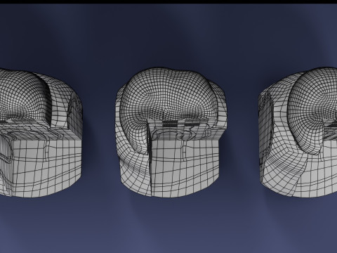 Caries Teeth severity schematic cut sectional 3Dモデル