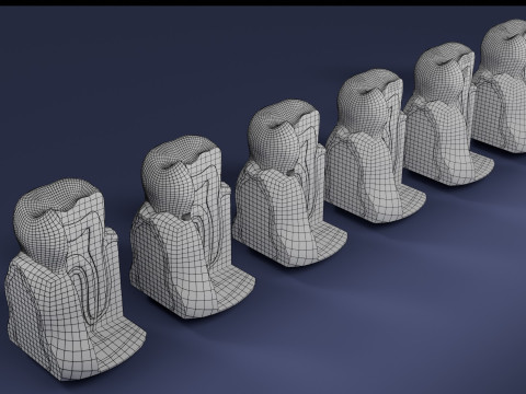 Caries Teeth severity schematic cut sectional 3Dモデル