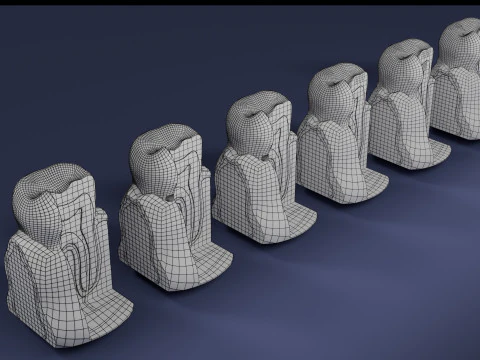 Caries Teeth severity schematic cut sectional 3D Model