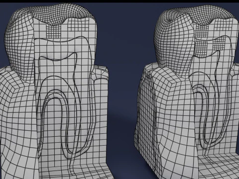 Caries Teeth severity schematic cut sectional 3D Model