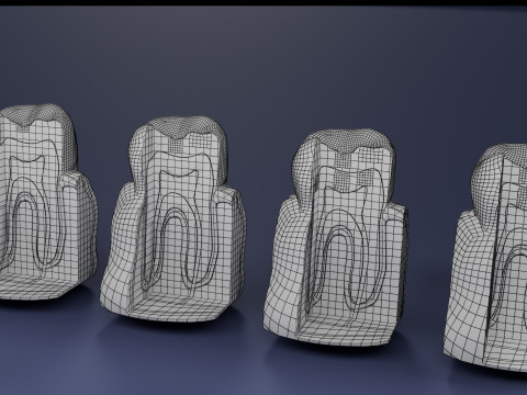 Caries Teeth severity schematic cut sectional 3Dモデル
