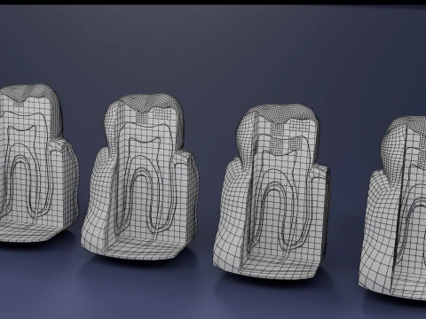 Caries Teeth severity schematic cut sectional 3D Model