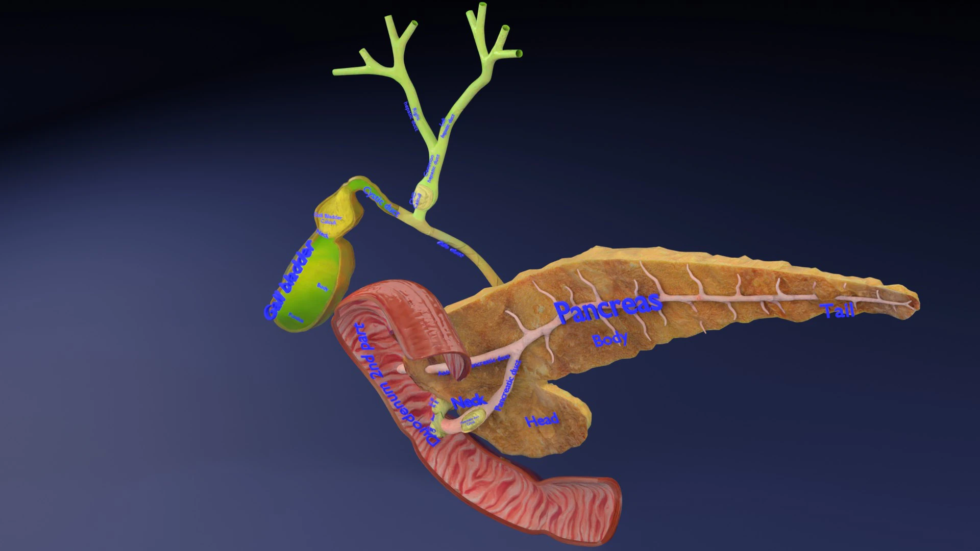 Biliary tract stone obstructions gallstone 3D Model .c4d .max .obj .3ds .fbx .stl .blend 