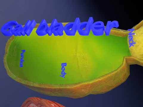 Biliary tract stone obstructions gallstone 3D Model