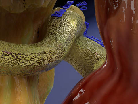 Biliary tract stone obstructions gallstone 3D 模型