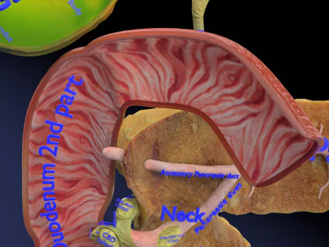 Biliary tract stone obstructions gallstone 3D Model