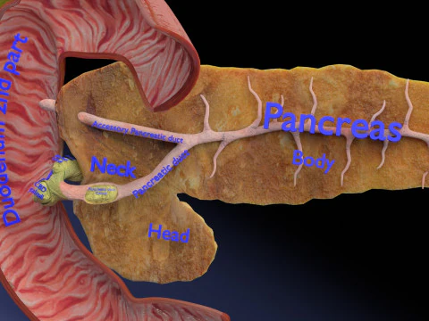 Biliary tract stone obstructions gallstone 3D Model