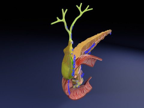 Biliary tract stone obstructions gallstone 3D 模型