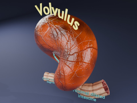 Volvulus intestine obstruction 3D Модель