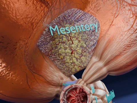 Volvulus intestine obstruction 3D Model