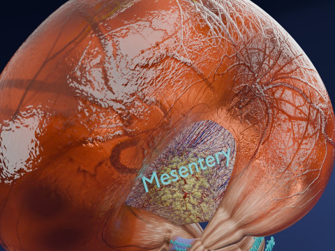 Volvulus intestine obstruction 3D Модель