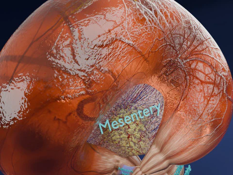 Volvulus intestine obstruction 3D Model