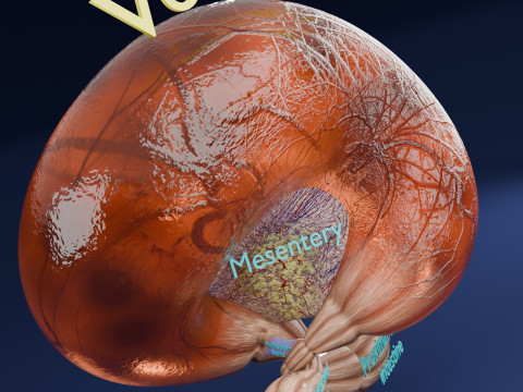 Volvulus intestine obstruction 3D Модель