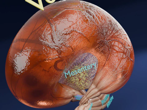 Volvulus intestine obstruction 3D Model