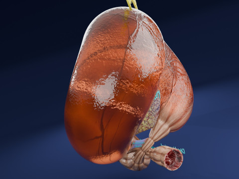 Volvulus intestine obstruction 3D Модель