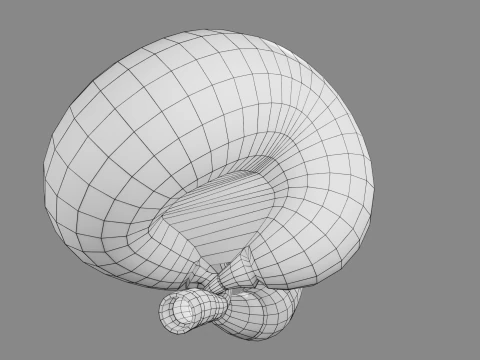 Volvulus intestine obstruction 3D Model