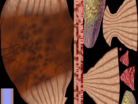 Volvulus intestine obstruction 3D Model