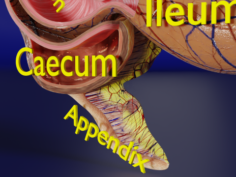 Intussusception intestine ileocolic obstruction 3D Модель