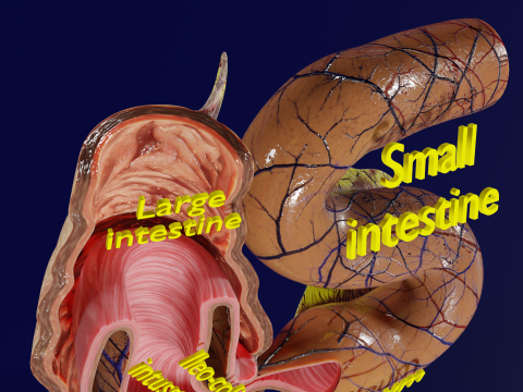 Intussusception intestine ileocolic obstruction 3D Модель