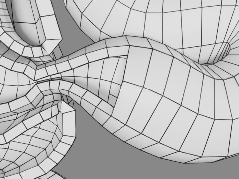 Intussusception intestine ileocolic obstruction 3D Model