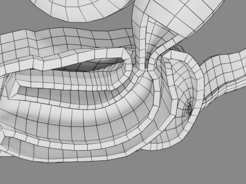 Intussusception intestine ileocolic obstruction 3D Модель