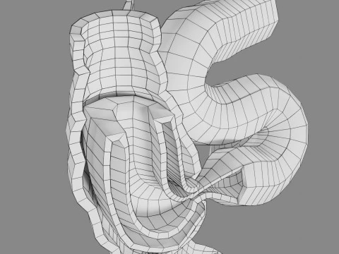 Intussusception intestine ileocolic obstruction 3D Model