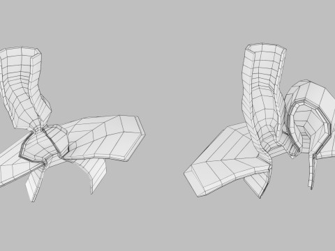 Hiatal hernia stomach sliding paraesophageal 3D Model