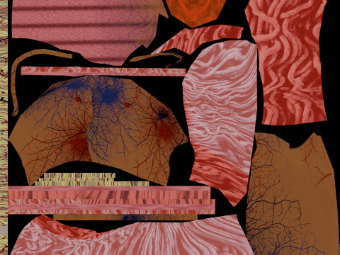 Hiatal hernia stomach sliding paraesophageal 3D Model