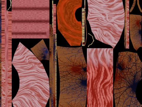 Hiatal hernia stomach sliding paraesophageal 3D Model