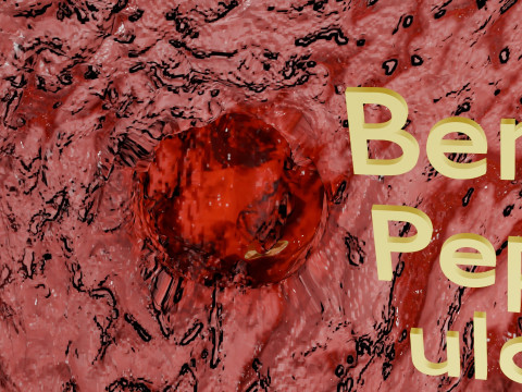Gastric Ulcer Benign versus Malignant Modello 3D