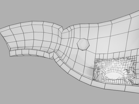 Gastric Ulcer Benign versus Malignant Modello 3D