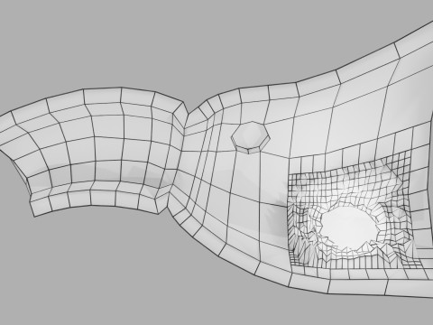 Gastric Ulcer Benign versus Malignant Modello 3D