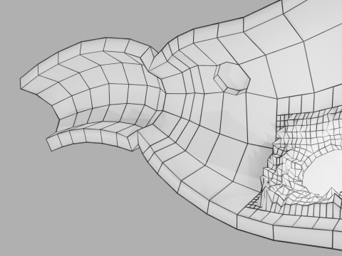 Gastric Ulcer Benign versus Malignant Modello 3D