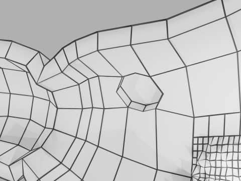 Gastric Ulcer Benign versus Malignant Modello 3D