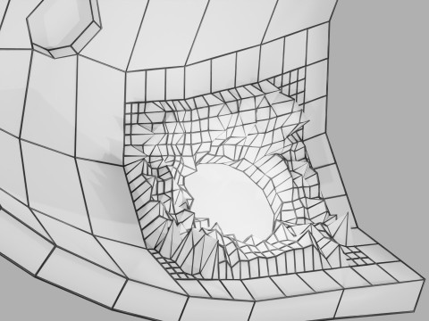 Gastric Ulcer Benign versus Malignant Modello 3D