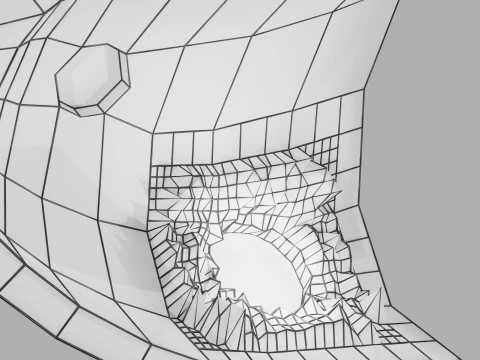 Gastric Ulcer Benign versus Malignant 3D Model