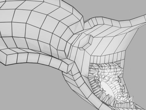 Gastric Ulcer Benign versus Malignant Modello 3D