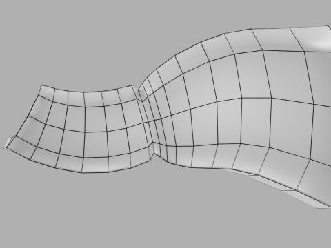 Gastric Ulcer Benign versus Malignant Modello 3D