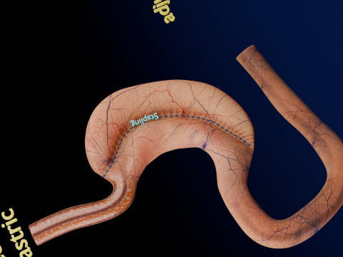 Bariatric Surgery Types 3D Модель